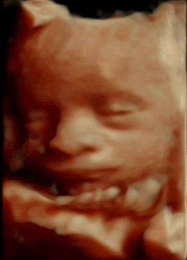 Baby 3D Ultraschall 30. Schwangerschaftswoche Baby 3D Ultraschall in der 30. SSW