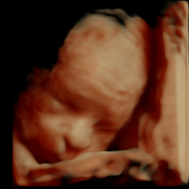 Baby 3D Ultraschall 26. Schwangerschaftswoche Baby 3D Ultraschall in der 26. SSW