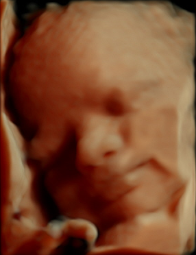 Baby 3D Ultraschall 27. Schwangerschaftswoche Baby 3D Ultraschall 27. SSW